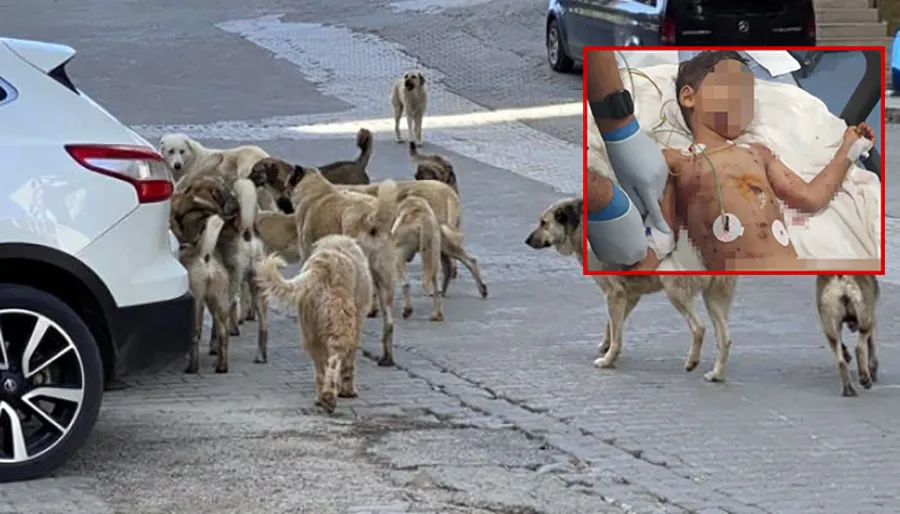 Sokak köpeklerinin saldırdığı 5 yaşındaki Abbas ağır yaralandı