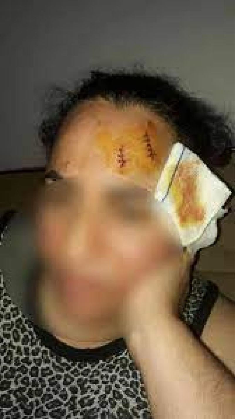 Komşusunu tencereyle yaralayan kadına 3 ay 22 gün hapis cezası